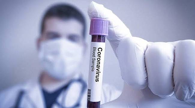 Yeni Coronavirüs ile ilgili merak edilen 9 soru 9 cevap 