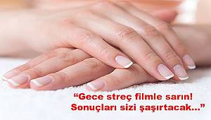 Ellerde oluşan çatlaklara 12 etkili çözüm!