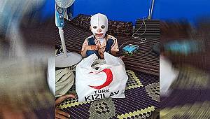 Savaş mağduru küçük Halid'e şefkat eli 