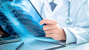 Akciğer kanserinde bu ilk belirtilere dikkat!  