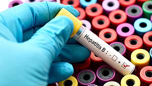 Hepatit Hastalığı, Yemek Borusu Varisi İçin Risk Oluşturuyor