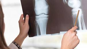 Güçlü Kemikler İçin Beslenme Alışkanlıkları 