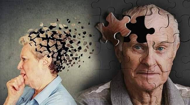 Demans ve Alzheimer Arasındaki Farklar Nelerdir? 