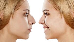 Burun Estetiği İle İlgili Merak Edilen Sorular 