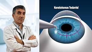 Keratokonus matematik terimi değil ama çözülmesi gereken bir problem! 