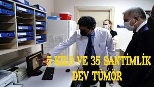 Göğüs boşluğundan 5 kilo ve 35 santimlik dev tümör çıkarıldı 