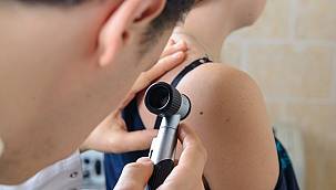 Yapay Zeka İle Ben Takibi Cilt Kanserine Karşı Önlem Almanızı Sağlıyor  