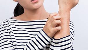 Kaşıntı Neden Olur? Kaşıntıya Ne İyi Gelir?  