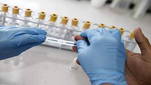 Ege'nin tek merkezinden Konak'ta ücretsiz hizmet 