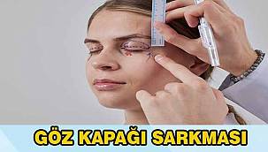 Sarkan Göz Kapakları: Estetik Bir İhtiyaç mı, Yoksa Ciddi Bir Görme Sorunu mu? 